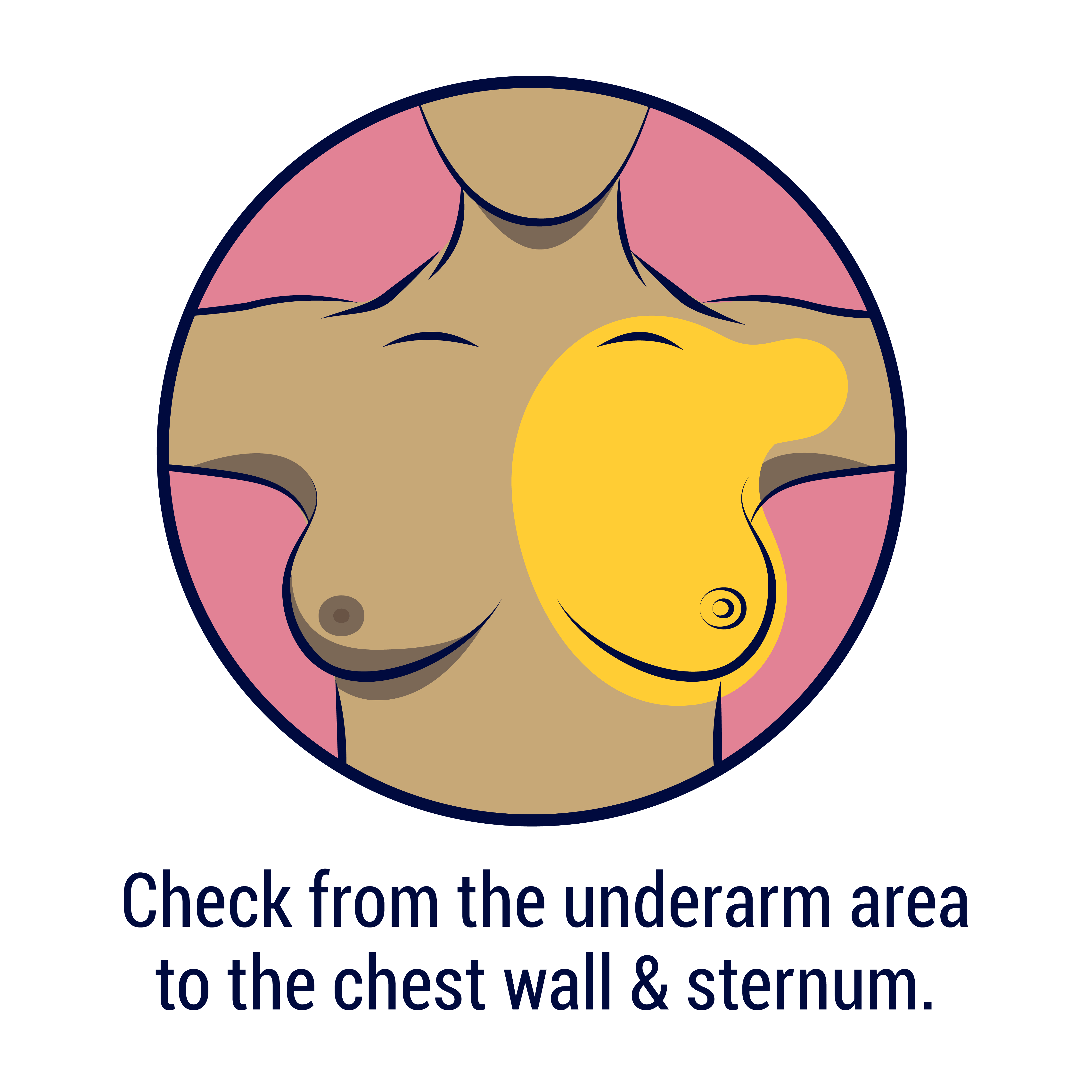 Check from the underarm area to the chest wall & sternum.